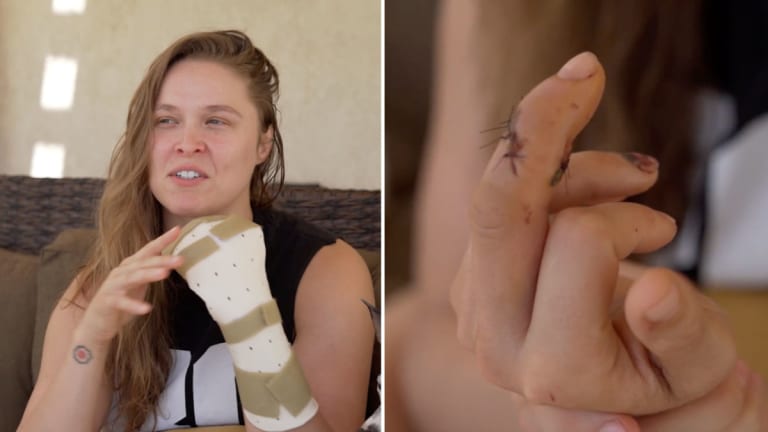 Ronda Rousey Finger Injury Detailed In New Video Sports