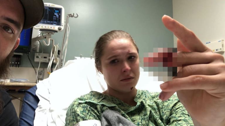 Ronda Rousey Finger Photo From 911 On Fox Filming Accident