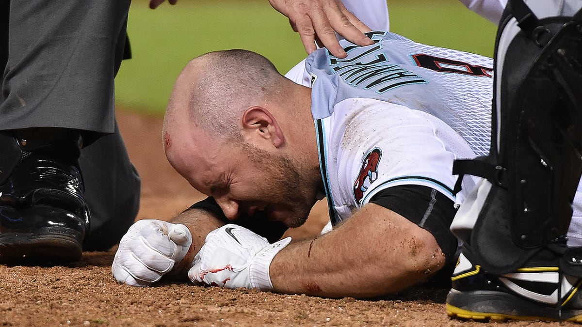 D-Backs' Chris Iannetta hit in face by pitch