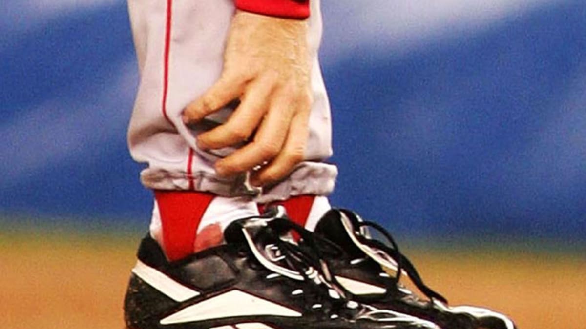 Curt Schilling tweets ghastly photo of his 'Bloody Sock' ankle