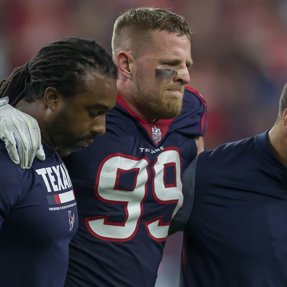 Source: Texans' J.J. Watt has minor knee surgery