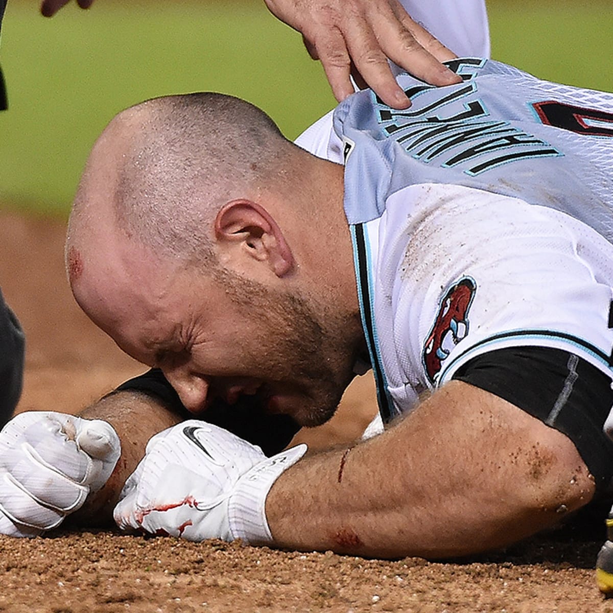 D-Backs' Chris Iannetta hit in face by pitch