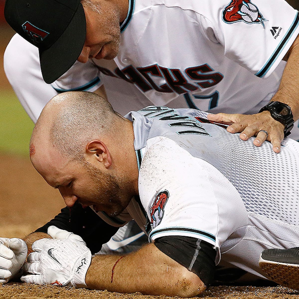 Chris Iannetta available to play after being hit by pitch in mouth