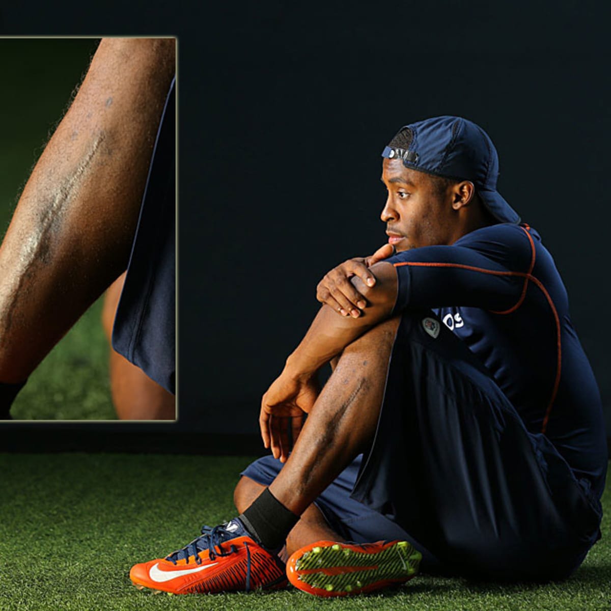 Denver Broncos safety Rahim Moore nearly lost left leg—and his