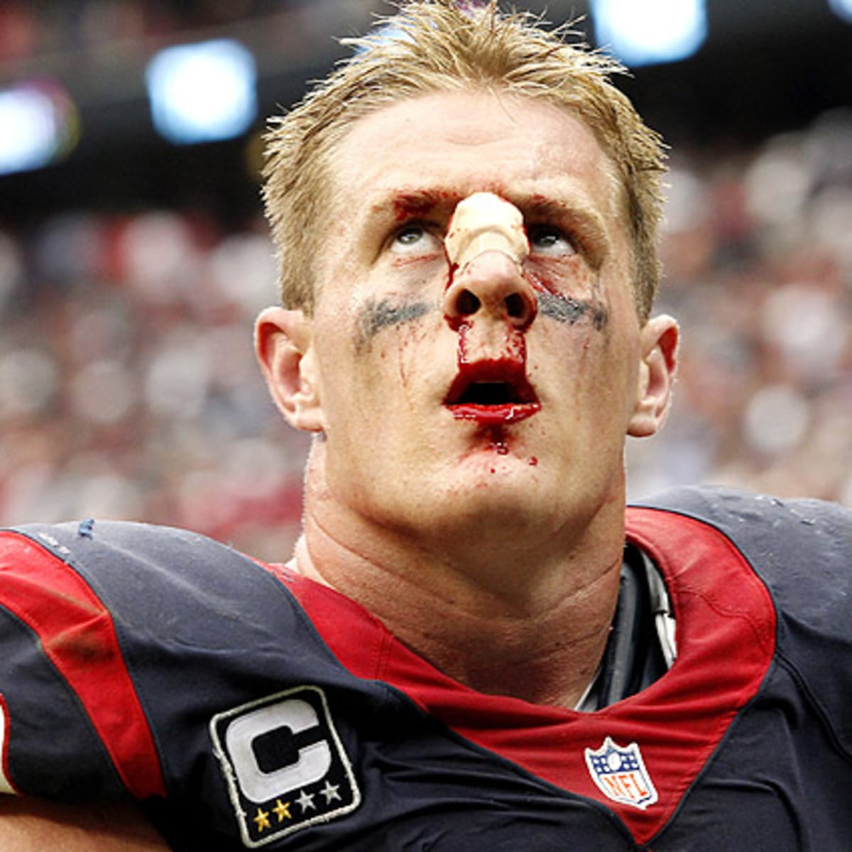 J.J. Watt injury: Texans star cuts pinky at 2013 Pro Bowl 