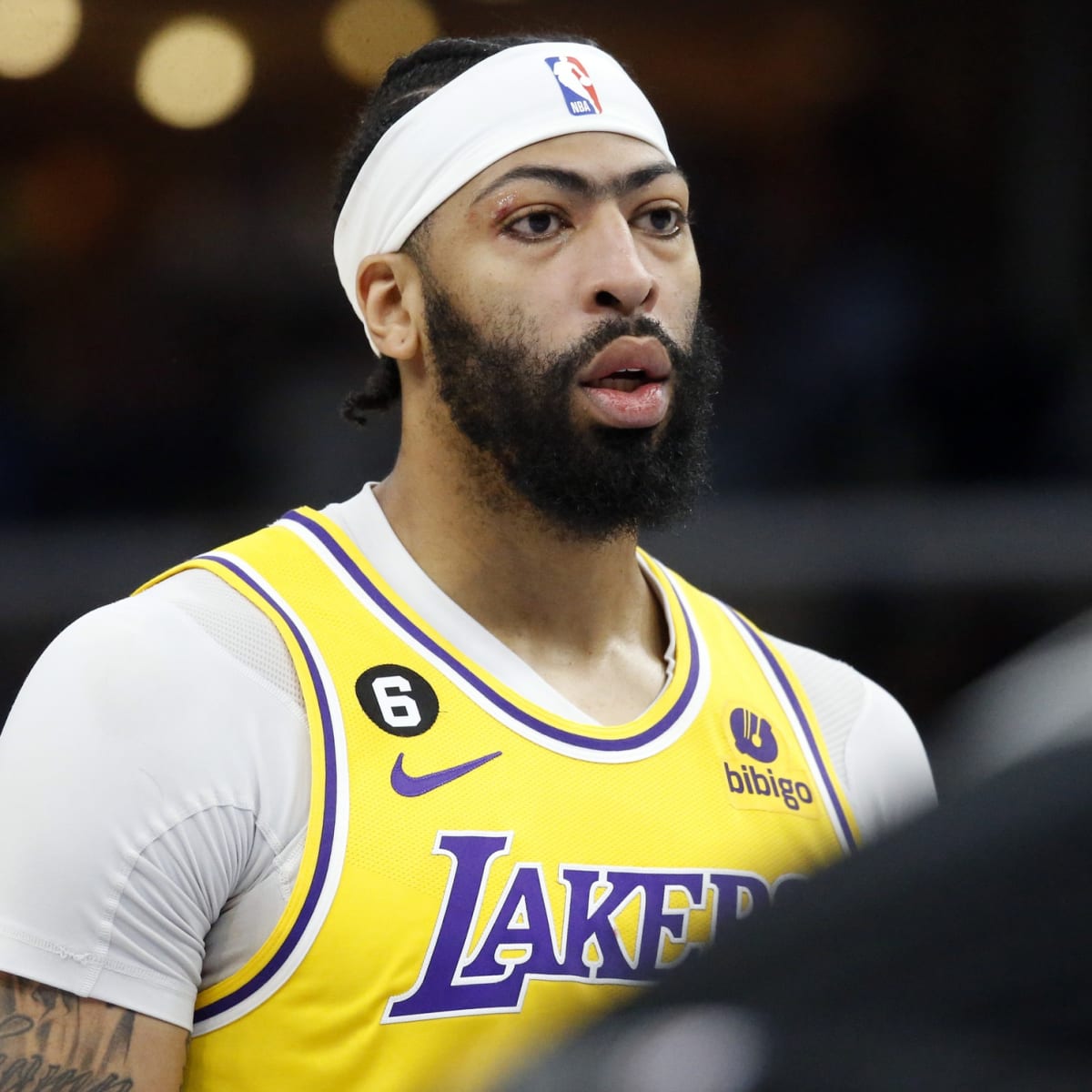 Lakers Rumors: Anthony Davis Could Return from Knee Injury Toward End of  January, News, Scores, Highlights, Stats, and Rumors