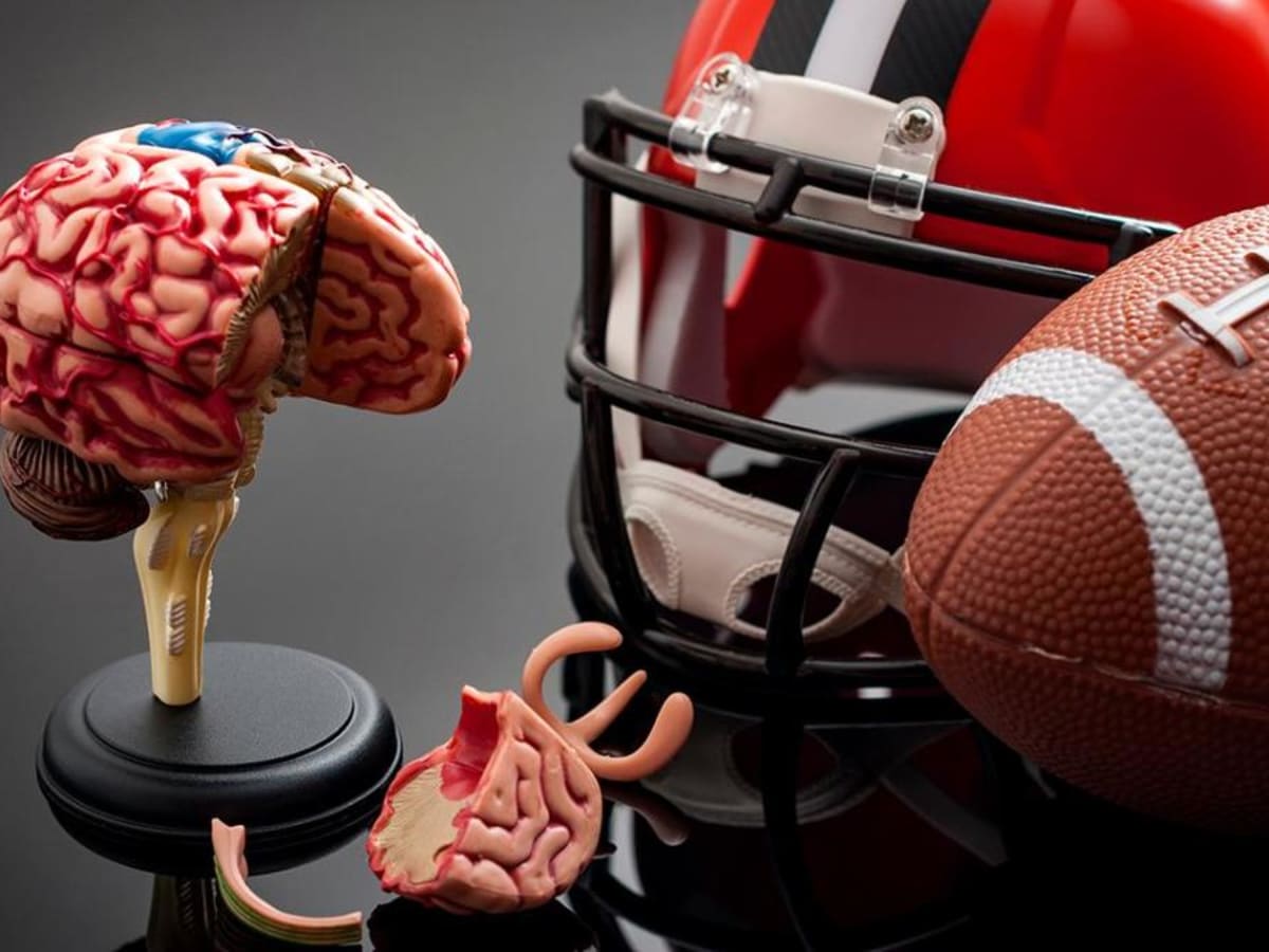 Study: 110 of 111 brains, including three former Dolphins, had CTE