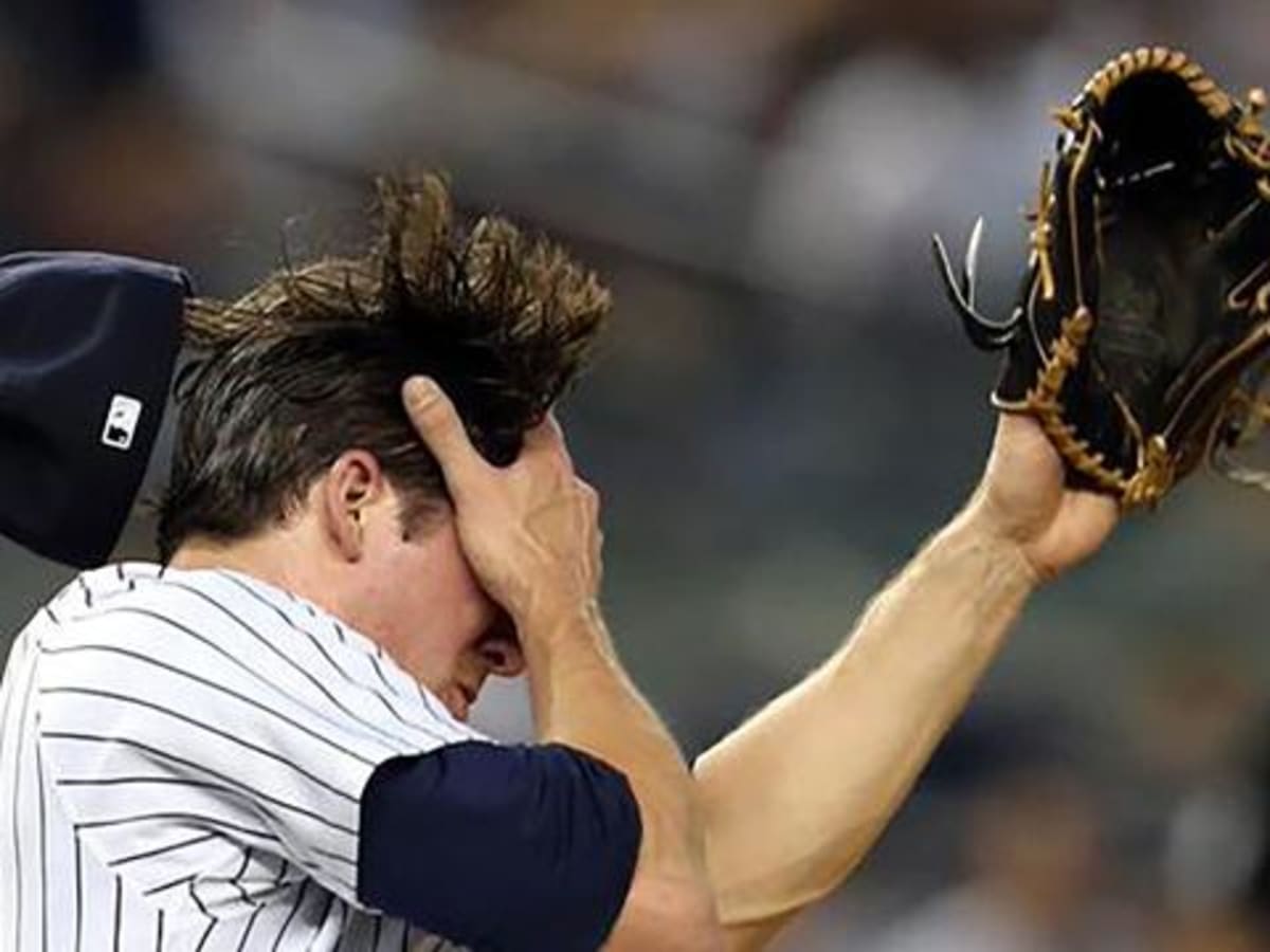 Yankees pitcher Bryan Mitchell hit in face by line drive, has