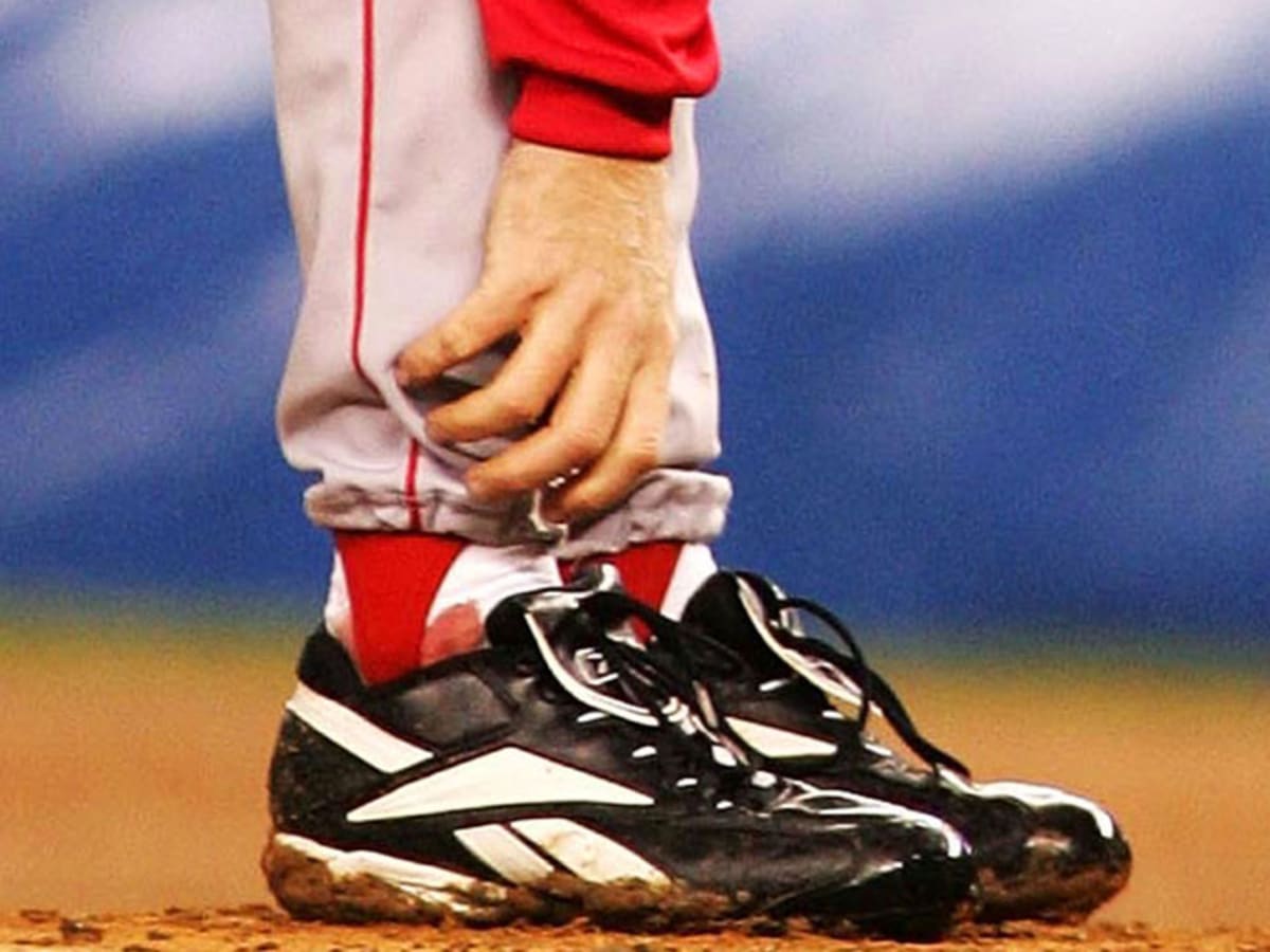 Curt Schilling tweets old picture from 2004 Bloody Sock Game - Sports  Illustrated