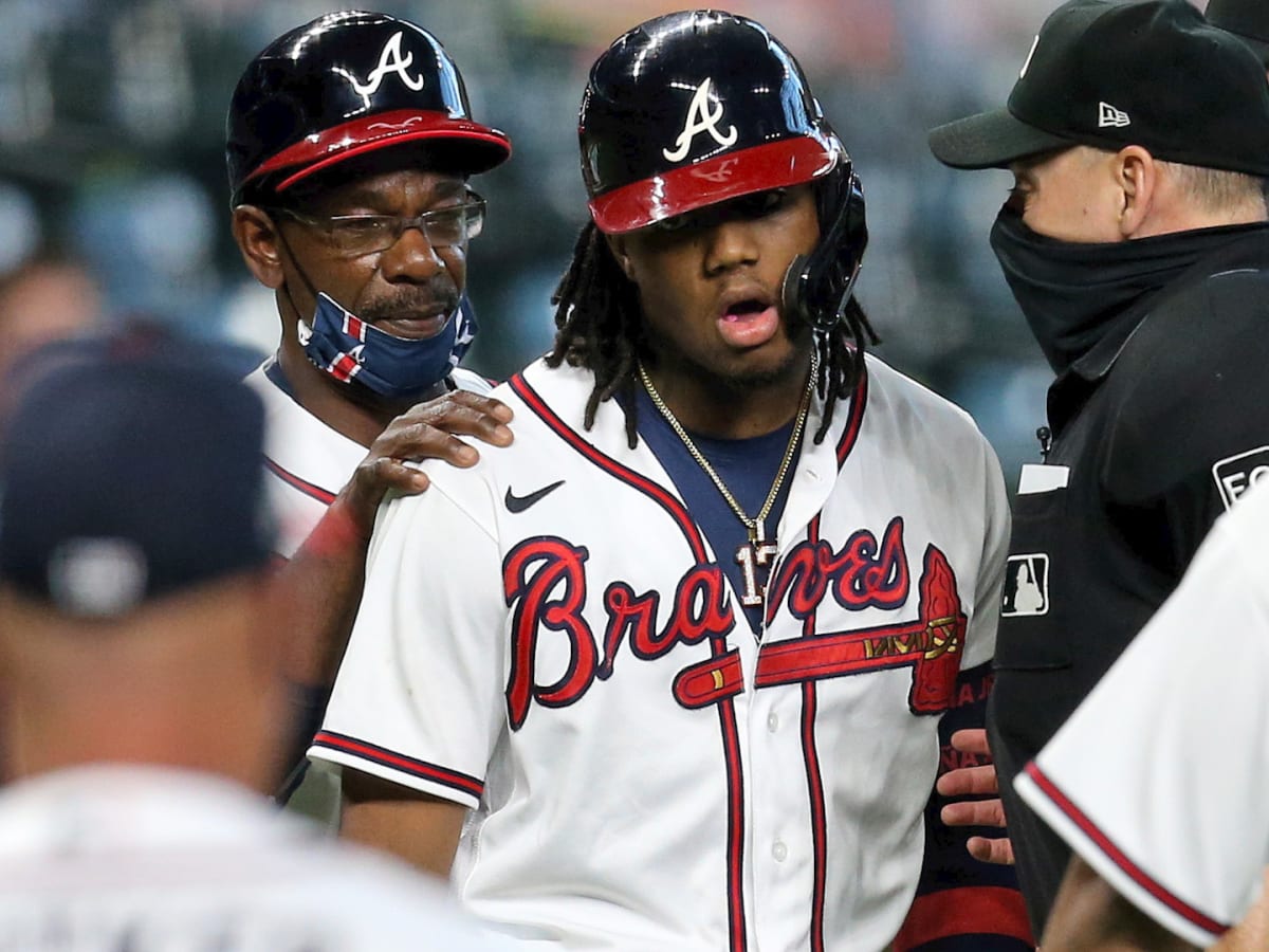 Ronald Acuna's bizarre hit-by-pitch mark against Marlins increases