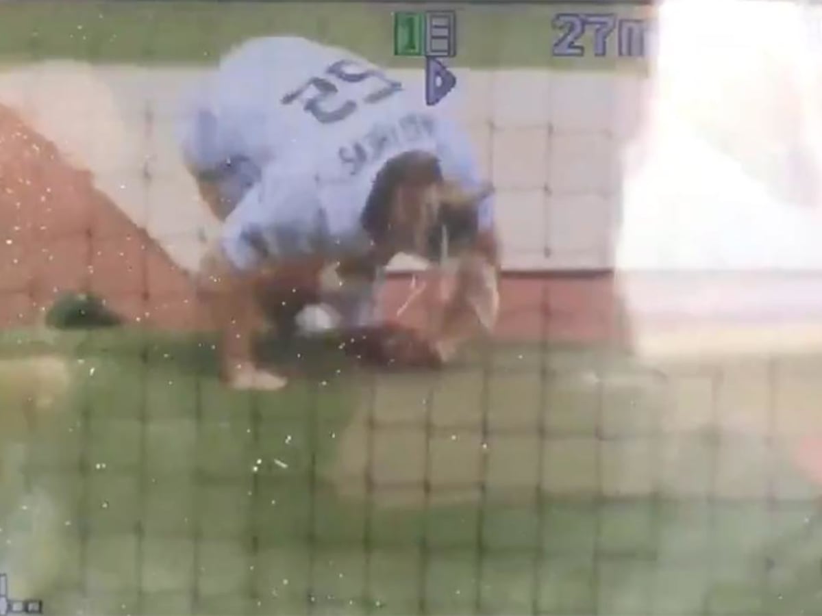 Green Bay Packers Clay Mathews takes line drive to face