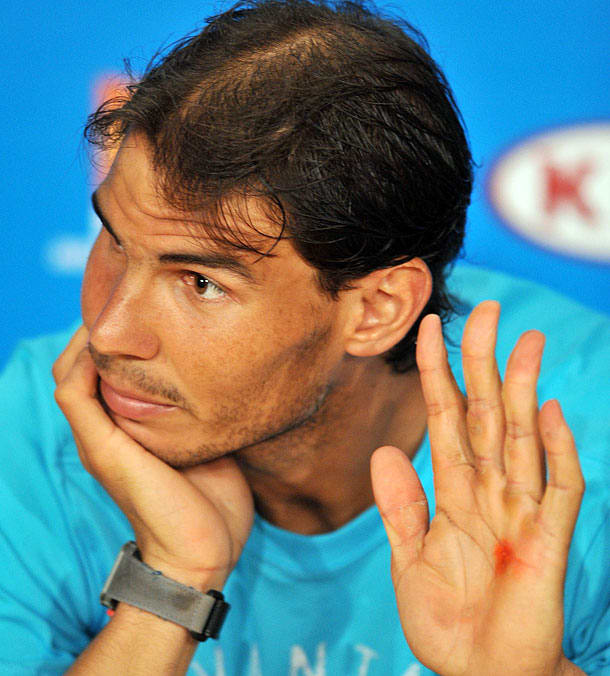 Rafael Nadal treated for nasty blister on hand at Australian Open