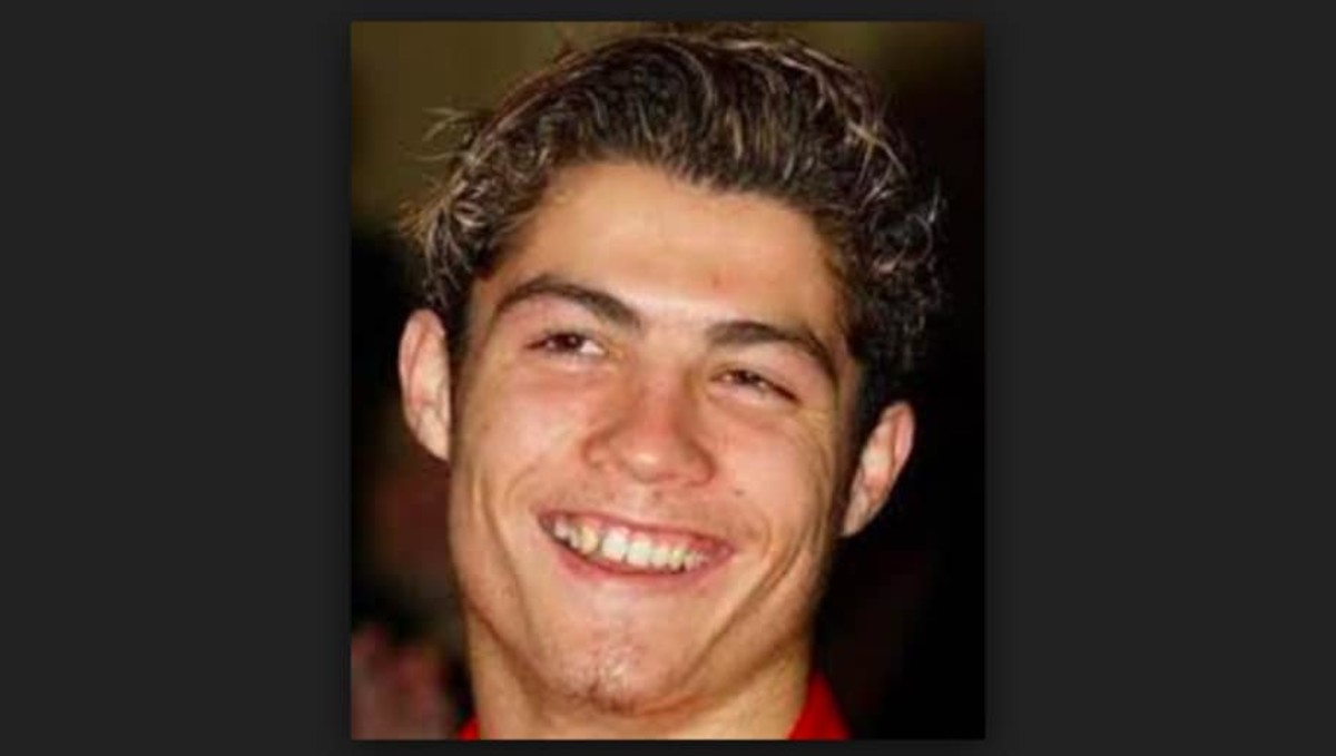 dientes de cristiano ronaldo