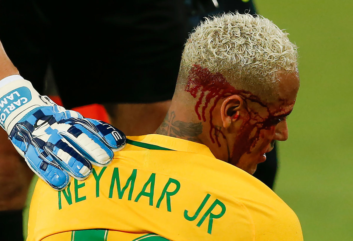 2016-1007-Neymar-bleeding.jpg