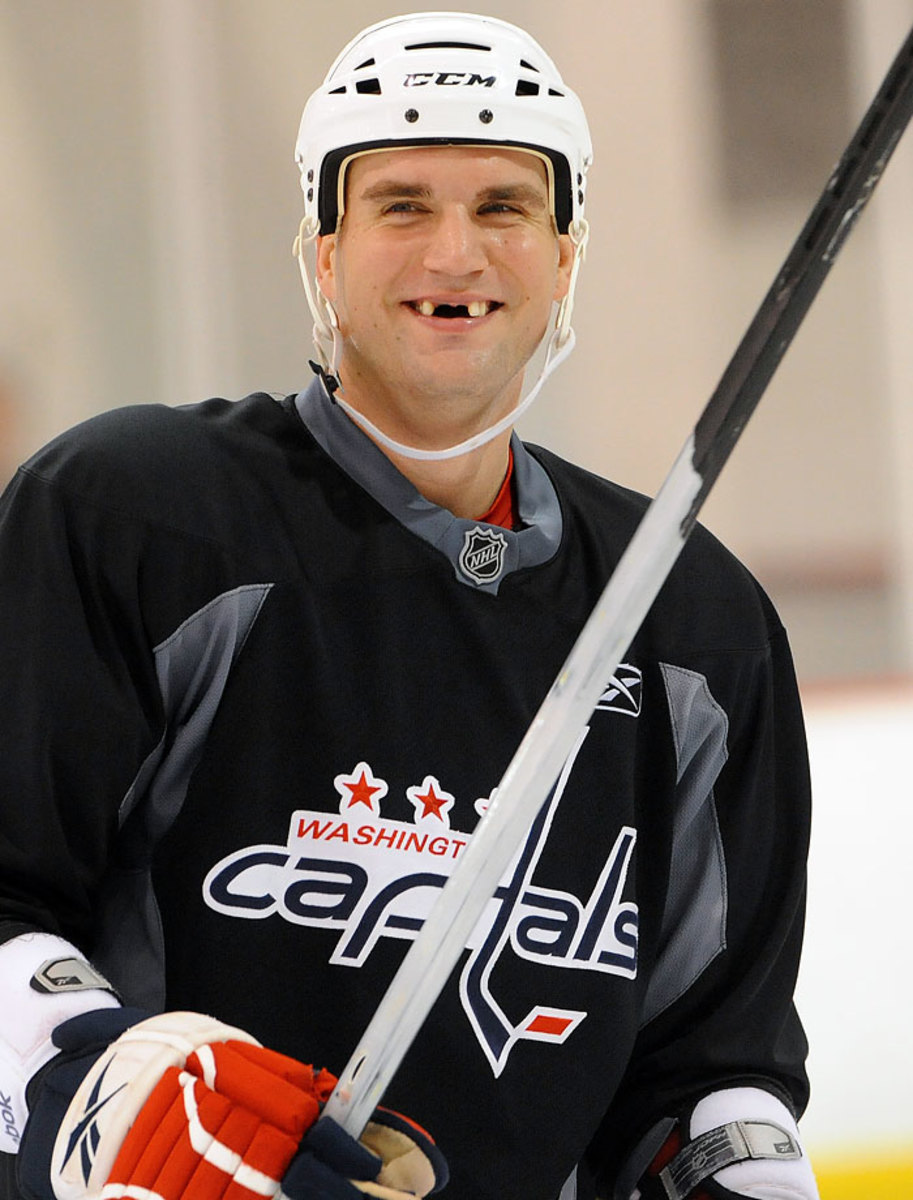 Hockey smiles: Many players opt not to replace their missing teeth