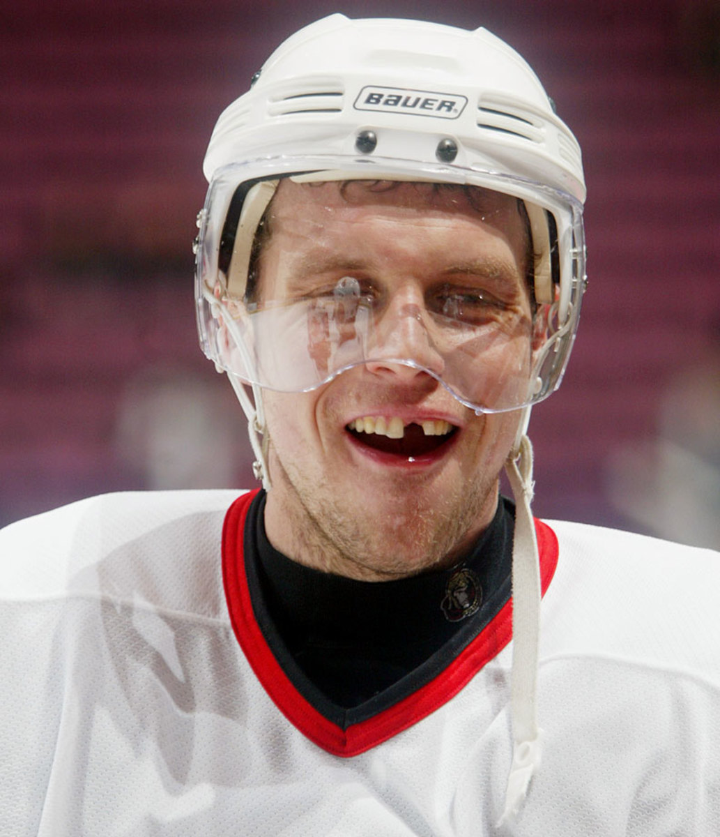 NHL players say losing their teeth is just part of the game