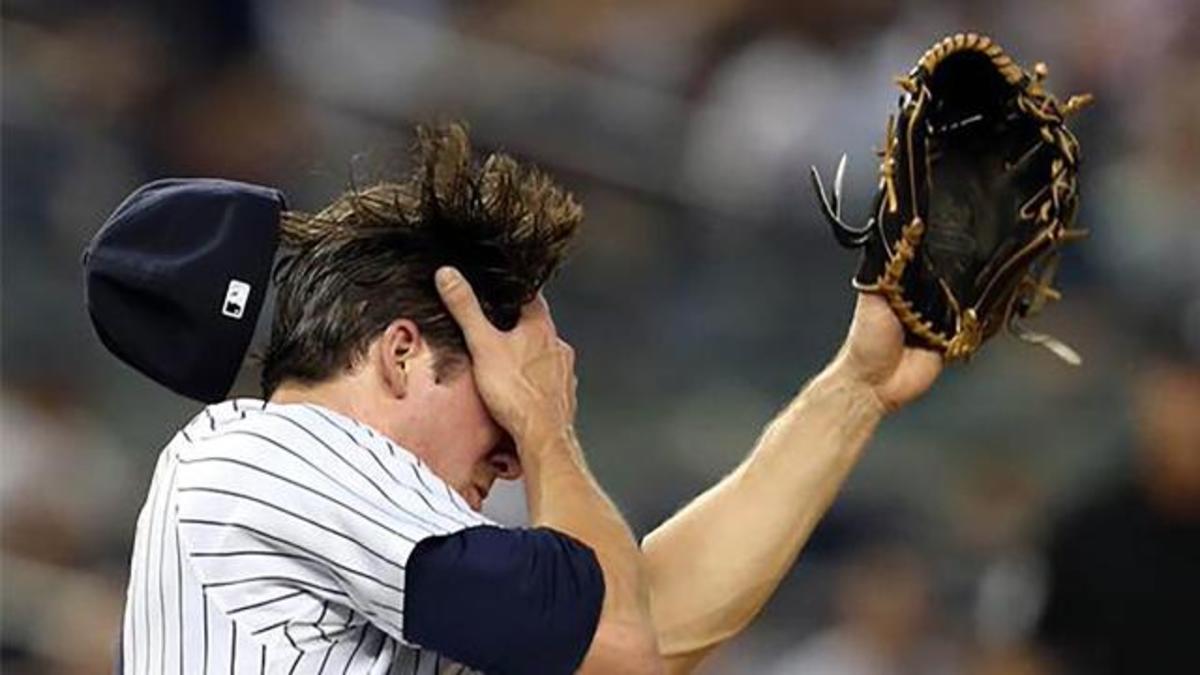 Yankees' line-drive victim facing serious procedure 