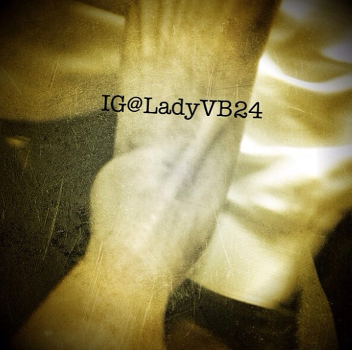 Kobe Bryant's sprained left ankle. (Vanessa Bryant)