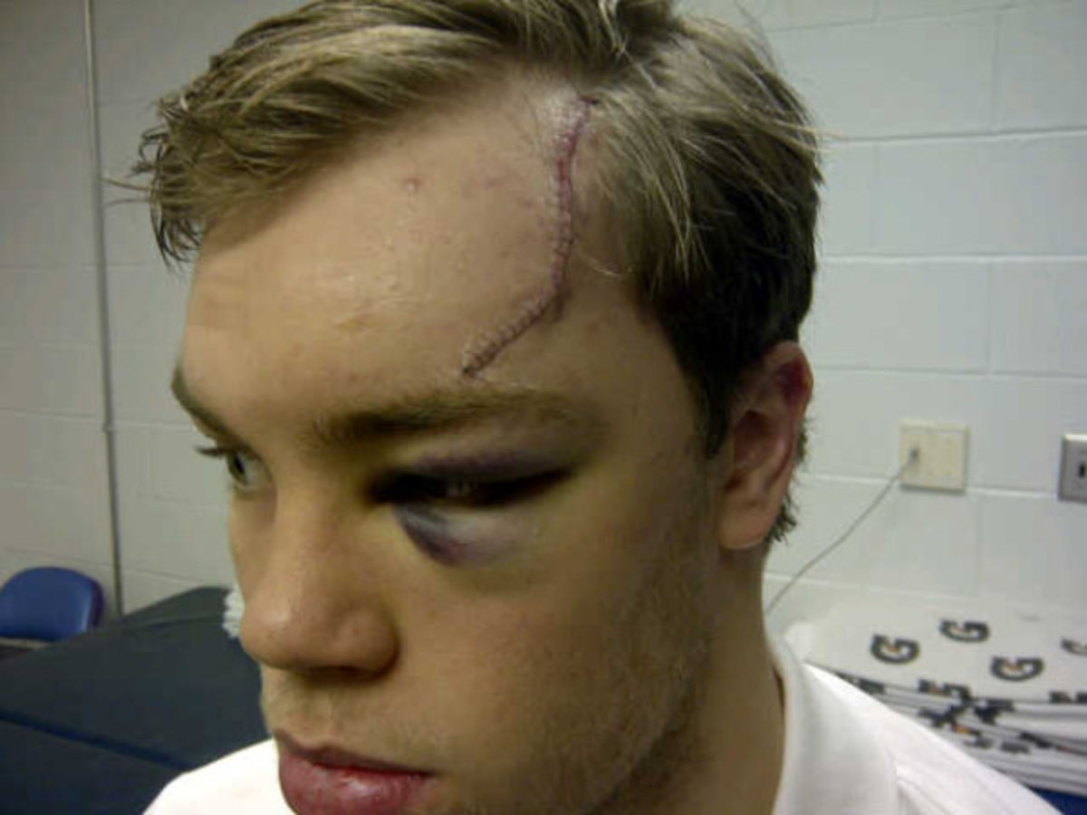 Taylor Hall