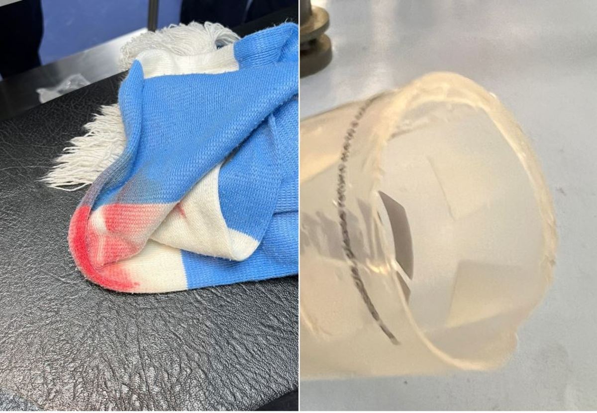 Images of a bloodied Manchester City scarf and a cracked plastic pint cup, as shared by the father of a 15-year-old girl who was injured in the crowd during City's EFL Cup game against Liverpool in December 2022