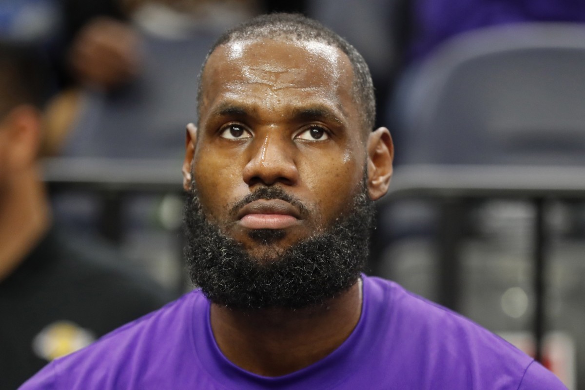 Lebron James Hair Grows Back