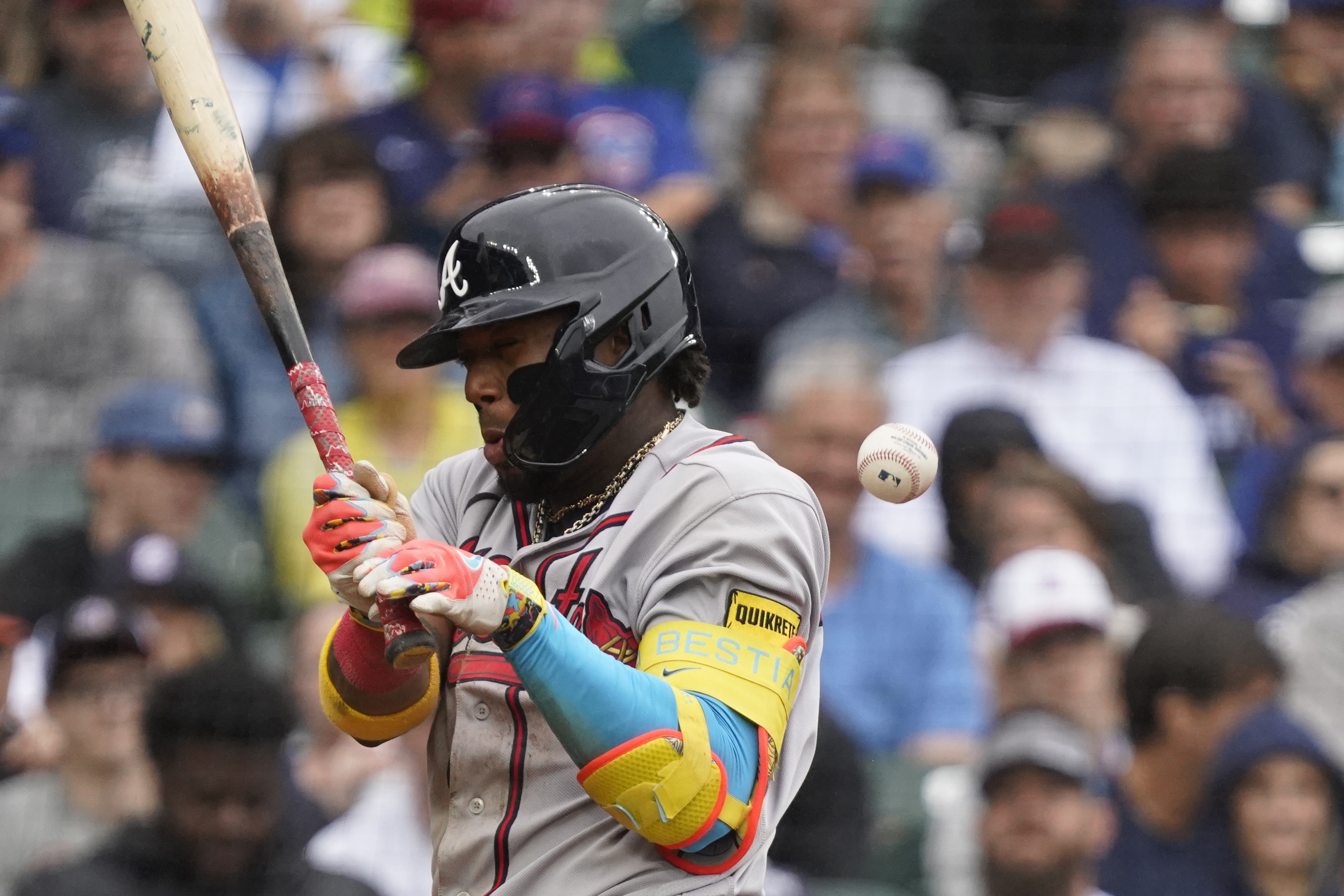 Braves' Ronald Acuña Jr. hit on the left elbow by a pitch, leaves