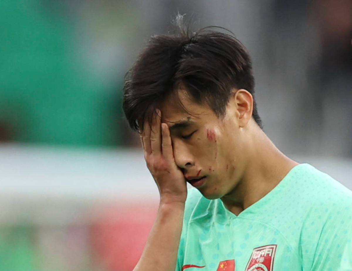 China midfielder Dai Wai Tsun pictured with multiple cuts on his face after his team's 0-0 draw with Lebanon at the 2023 AFC Asian  Cup in January 2024